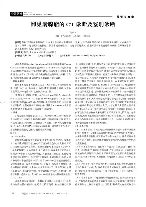 卵巢囊腺瘤的CT诊断及鉴别诊断