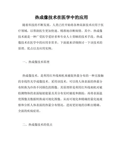 热成像技术在医学中的应用