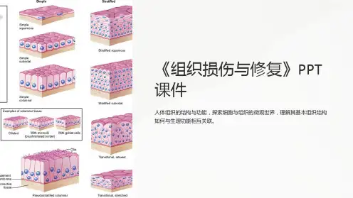 《组织损伤与修复》课件
