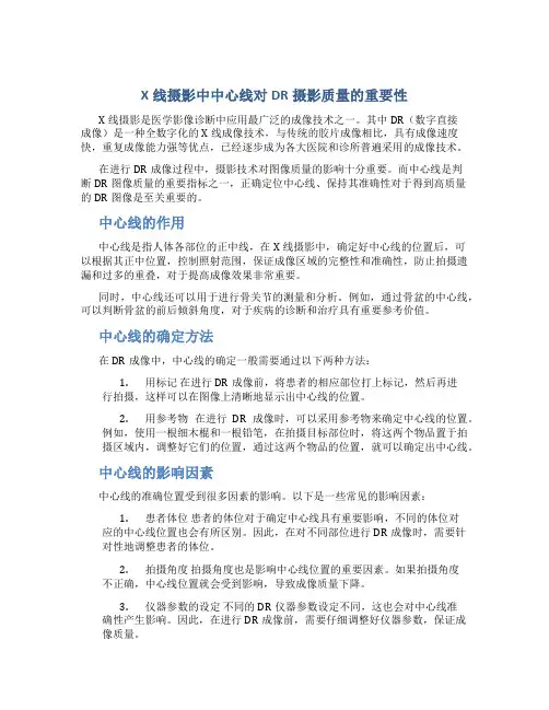 X线摄影中中心线对DR摄影质量的重要性