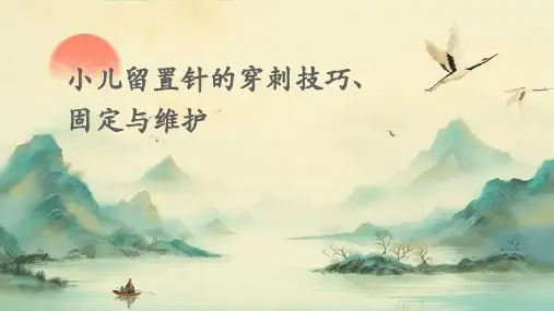 小儿留置针的穿刺技巧、固定与维护课件