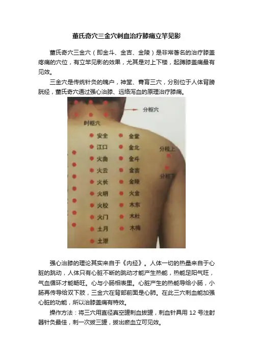 董氏奇穴三金穴刺血治疗膝痛立竿见影