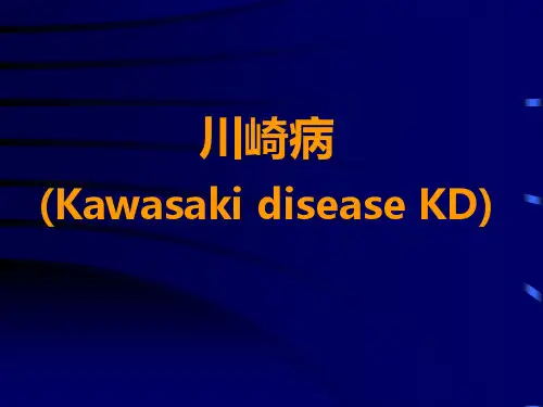 小儿川崎病PPT课件