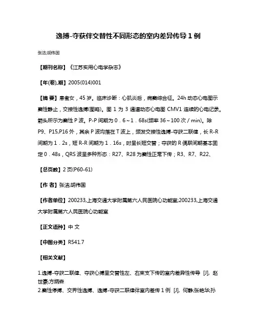 逸搏-夺获伴交替性不同形态的室内差异传导1例