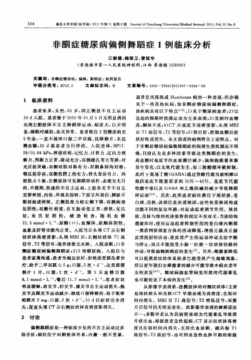 非酮症糖尿病偏侧舞蹈症1例临床分析