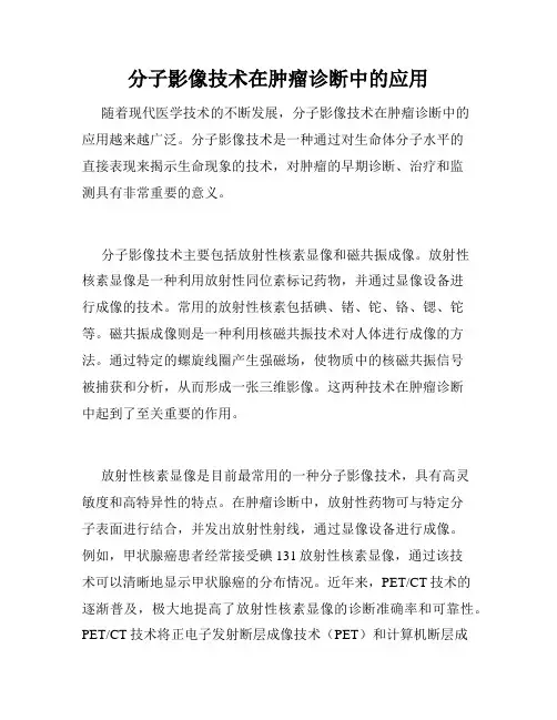 分子影像技术在肿瘤诊断中的应用
