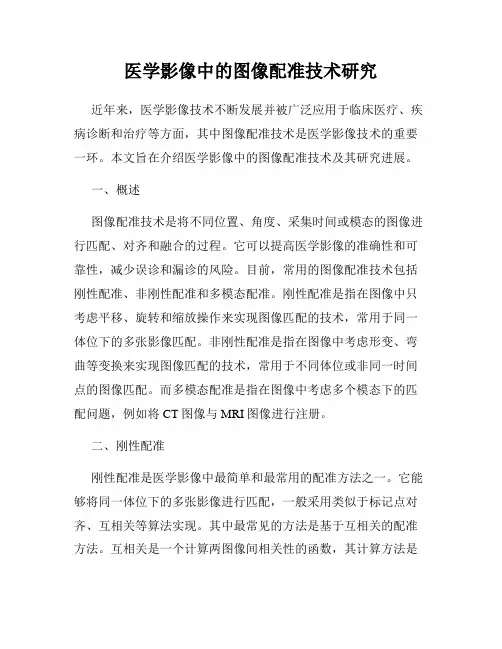 医学影像中的图像配准技术研究