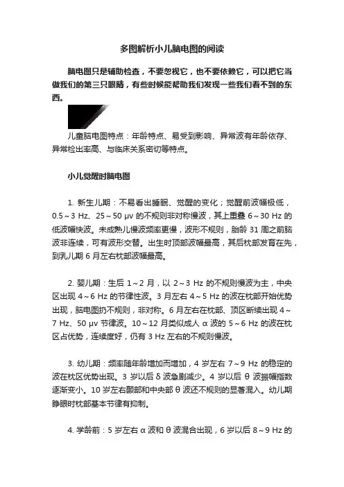 多图解析小儿脑电图的阅读