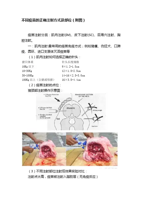 不同疫苗的正确注射方式及部位（附图）