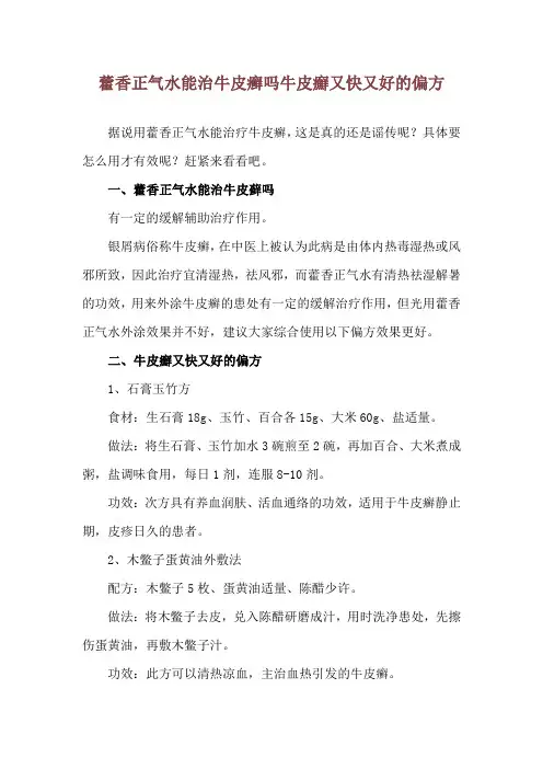 藿香正气水能治牛皮癣吗 牛皮癣又快又好的偏方