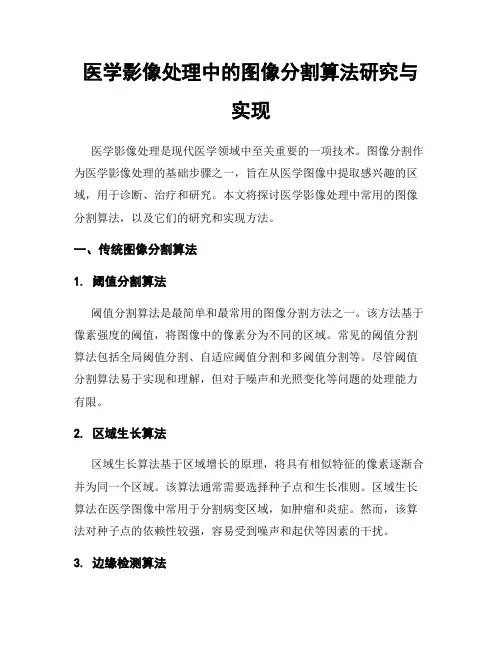 医学影像处理中的图像分割算法研究与实现