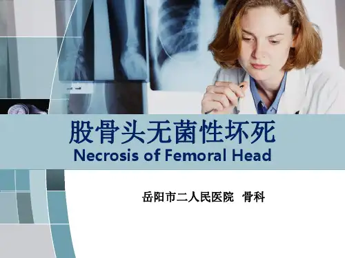 股骨头无菌性坏死PPT课件