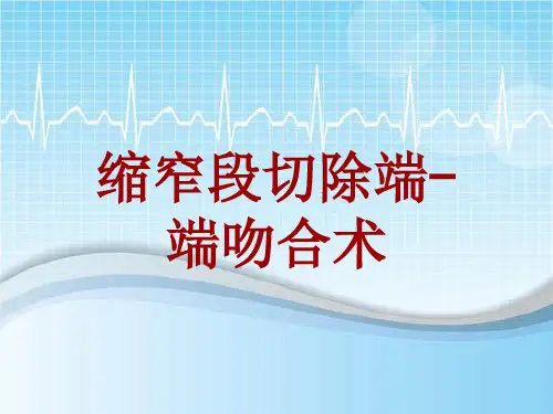 手术讲解模板：缩窄段切除端-端吻合术