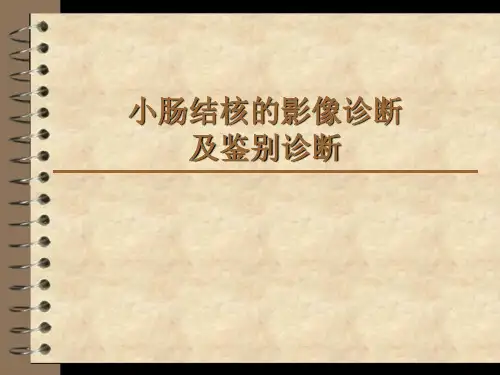 小肠结核的影像诊断及鉴别诊断