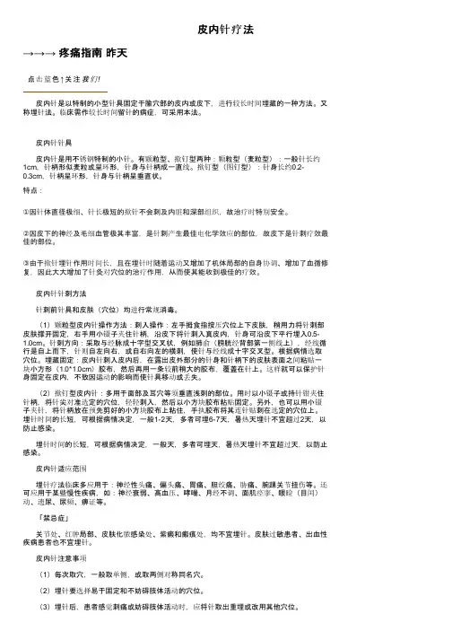 皮内针疗法——精选推荐