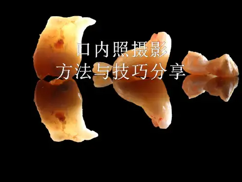 口腔摄影方法与技巧