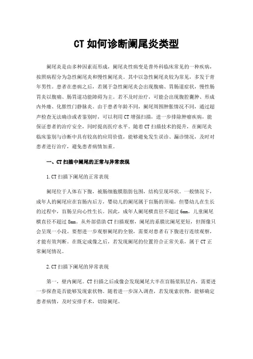 CT如何诊断阑尾炎类型