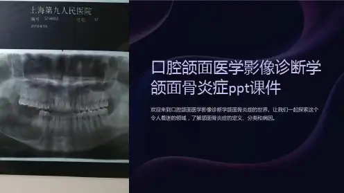 口腔颌面医学影像诊断学颌面骨炎症ppt课件