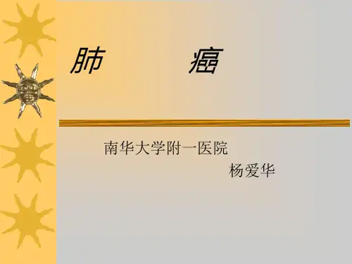 肺癌的CT诊断解析