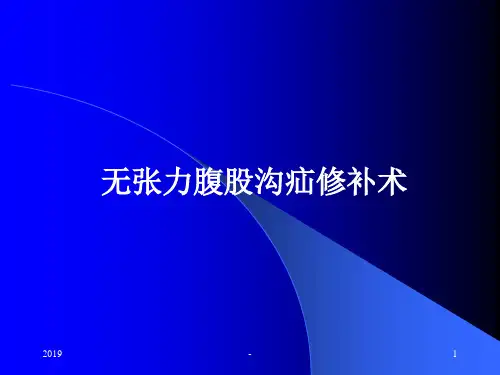 无张力腹股沟疝修补术ppt课件