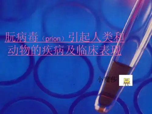 朊病毒引起人类和