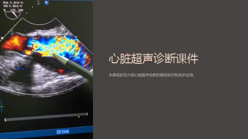 心脏超声诊断课件
