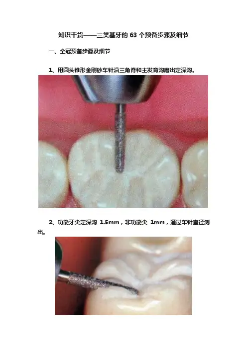 知识干货——三类基牙的63个预备步骤及细节