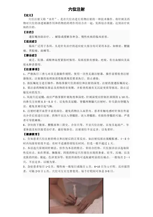 穴位注射相关知识