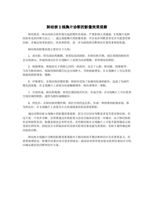 肺结核X线胸片诊断的影像效果观察