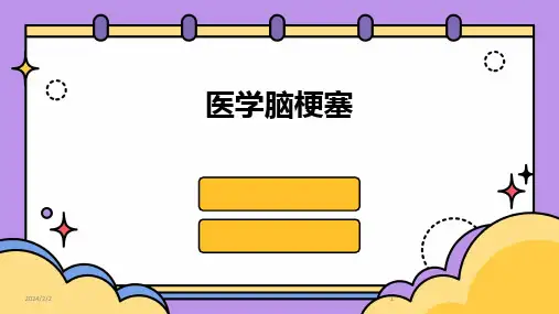 2024版年度医学脑梗塞