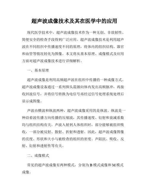 超声波成像技术及其在医学中的应用