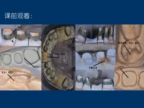 Ander丨牙体预备课件