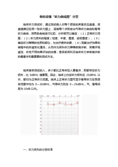 教你读懂“听力曲线图”分型
