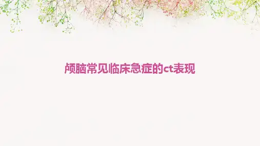 颅脑常见临床急症的CT表现