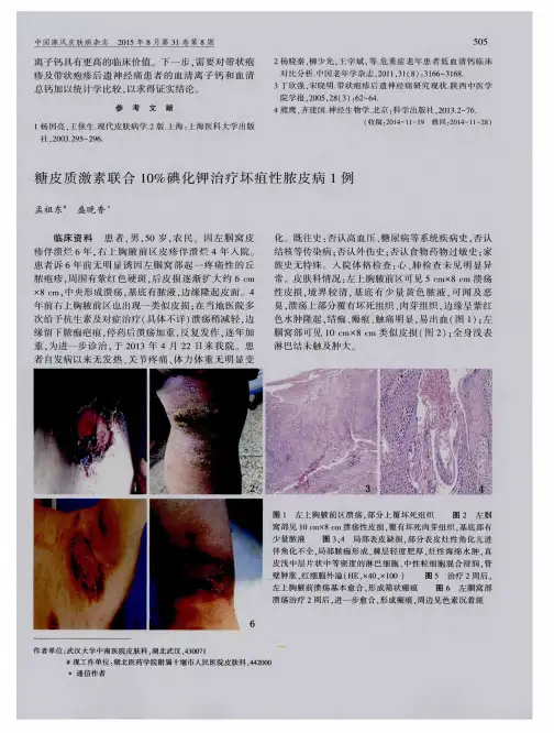 糖皮质激素联合10%碘化钾治疗坏疽性脓皮病1例