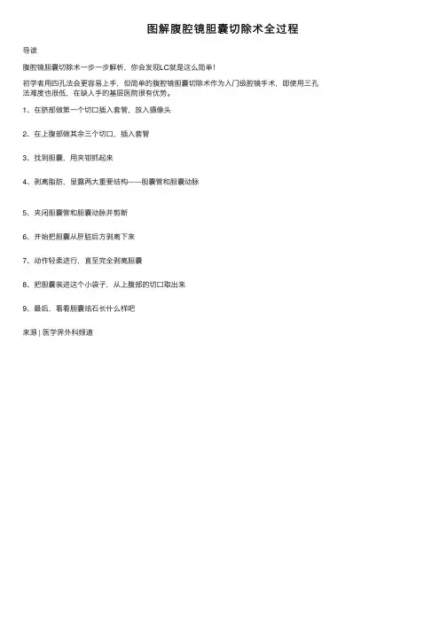 图解腹腔镜胆囊切除术全过程