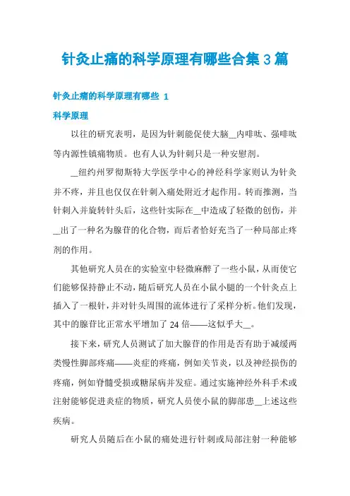 针灸止痛的科学原理有哪些合集3篇