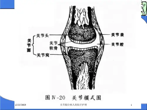 关节脱位病人的医疗护理课件