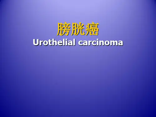 膀胱癌 PPT课件