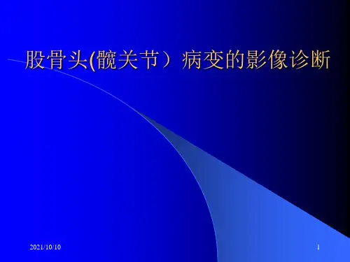 股骨头病变的影像诊断
