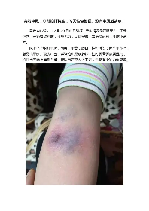 突发中风，立刻拍打拉筋，五天恢复如初、没有中风后遗症！