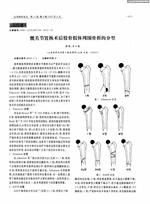 髋关节置换术后股骨假体周围骨折的分型