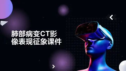 肺部病变CT影像表现征象课件