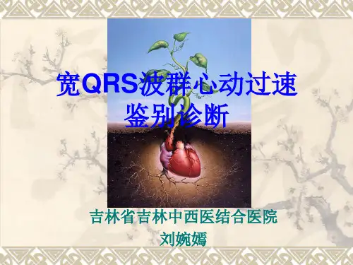 宽QRS波心动过速鉴别诊断