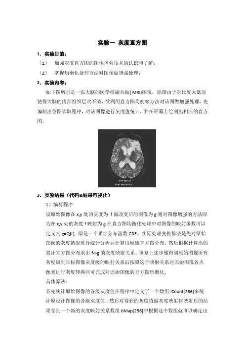 数字图像处理实验-灰度直方图