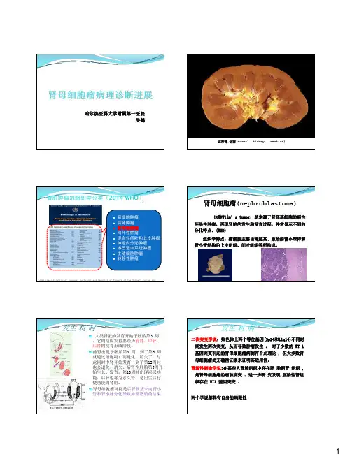 吴鹤-肾母细胞瘤病理诊断进展