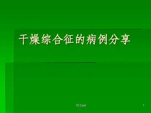 干燥综合征的病例分享