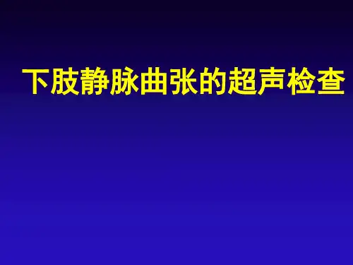 下肢静脉曲张的超声检查
