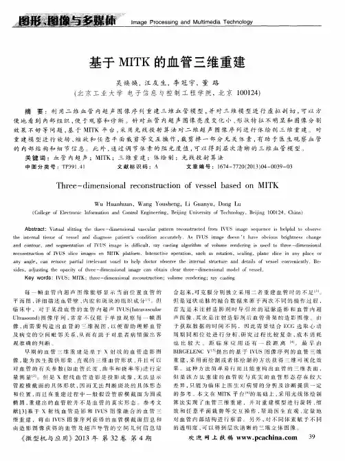 基于MITK的血管三维重建
