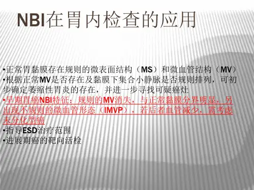 NBIME诊断早期胃癌技巧教学提纲